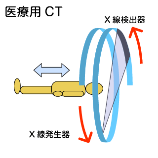 医療用CTスキャナ｜松定プレシジョン